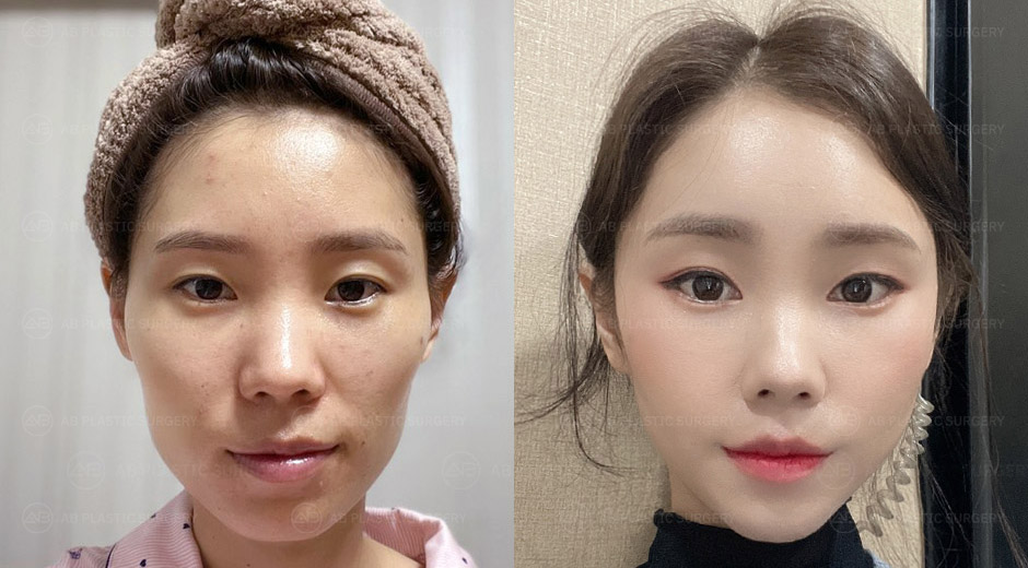 AB Plastic Surgery